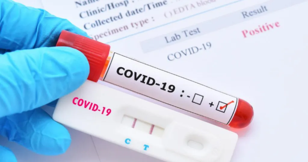 У Запорізькій області підтвердили смерть пацієнта з COVID-19, за тиждень зафіксували понад 400 випадків